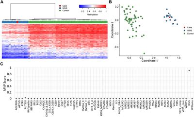 Genetically unresolved case of Rauch-Steindl syndrome diagnosed by its wolf-hirschhorn associated DNA methylation episignature